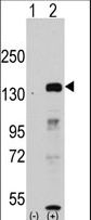 JHDM1A / KDM2A Antibody - Western blot of JHDM1a/FBXL11 (arrow) using rabbit polyclonal JHDM1a/FBXL11 Antibody. 293 cell lysates (2 ug/lane) either nontransfected (Lane 1) or transiently transfected with the JHDM1a/FBXL11 gene (Lane 2) (Origene Technologies).