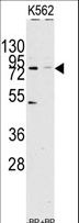 JHDM1A / KDM2A Antibody - Western blot of anti-JHDM1a/FBXL11 Antibody pre-incubated with(right lane) and without(left lane) blocking peptide in Jurkat cell line lysate. JHDM1a(arrow) was detected using the purified antibody.