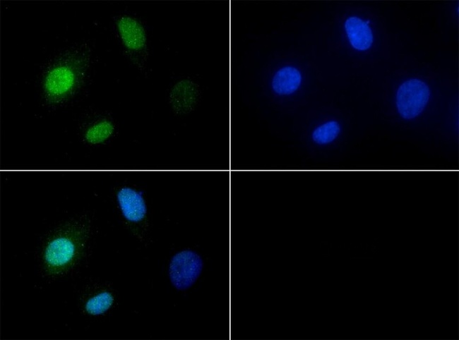 JHDM1A / KDM2A Antibody - Immunocytochemistry/Immunofluorescence: KDM2A/FBXL11 Antibody - Antibody was tested in HeLa cells with FITC (green). Nuclei were counterstained with DAPI (blue).  This image was taken for the unconjugated form of this product. Other forms have not been tested.