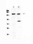 JHDM1A / KDM2A Antibody - Western blot - Anti-FBXL11 Picoband antibody