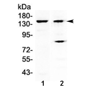 JHDM1A / KDM2A Antibody - Western blot testing of 1) mouse liver and 2) human A431 lysate with FBXL11 antibody at 0.5ug/ml. Predicted molecular weight ~133 kDa.