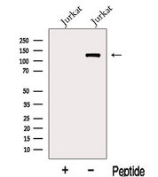 JHDM1A / KDM2A Antibody - Western blot analysis of extracts of Jurkat cells using KDM2A antibody. The lane on the left was treated with blocking peptide.