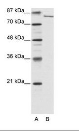 JHDM1A / KDM2A Antibody - A: Marker, B: HepG2 Cell Lysate.  This image was taken for the unconjugated form of this product. Other forms have not been tested.
