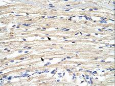 JHDM1A / KDM2A Antibody - KDM2A / FBXL11 antibody ARP31697_P050-AAH47486-FBXL11 (F-box and leucine-rich repeat protein 11) Antibody was used in IHC to stain formalin-fixed, paraffin-embedded human muscle.  This image was taken for the unconjugated form of this product. Other forms have not been tested.