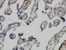 JMJD1C Antibody - Immunoperoxidase of monoclonal antibody to JMJD1C on formalin-fixed paraffin-embedded human placenta. [antibody concentration 3 ug/ml]