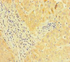 JMJD1C Antibody - Immunohistochemistry of paraffin-embedded human liver tissue at dilution of 1:100