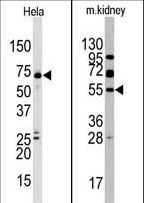 JMJD4 Antibody - Western blot of anti-JMJD4 antibody in HeLa and mouse kidney cell line lysate. JMJD4 (arrow) was detected using the purified antibody.