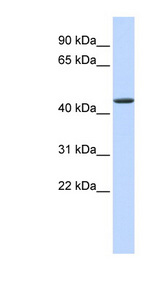 JMJD4 Antibody - JMJD4 antibody Western blot of Fetal Heart lysate. This image was taken for the unconjugated form of this product. Other forms have not been tested.