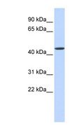JMJD4 Antibody - JMJD4 antibody Western blot of Fetal Heart lysate. This image was taken for the unconjugated form of this product. Other forms have not been tested.