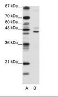 JMJD4 Antibody - A: Marker, B: Jurkat Cell Lysate.  This image was taken for the unconjugated form of this product. Other forms have not been tested.