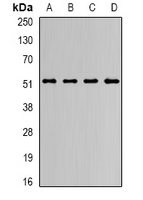 JMJD4 Antibody - Western blot analysis of JMJD4 expression in HepG2 (A); MCF7 (B); mouse brain (C); rat liver (D) whole cell lysates.