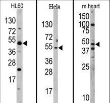 JMJD6 / PSR Antibody - Western blot of anti-PTDSR antibody (RB10820) in mouse heart, HeLa, and HL60 cell line lysates. PTDSR (arrow) was detected using the purified antibody.