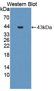 JMJD6 / PSR Antibody - Western blot of JMJD6 / PSR antibody.