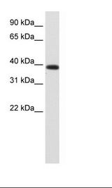 JMJD6 / PSR Antibody - Fetal Kidney Lysate.  This image was taken for the unconjugated form of this product. Other forms have not been tested.