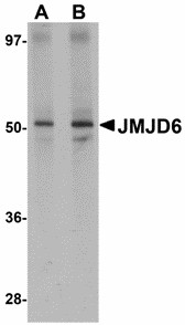 JMJD6 / PSR Antibody - Western blot of JMJD6 in human brain tissue lysate with JMJD6 antibody at (A) 1 and (B) 2 ug/ml. Below: Immunohistochemistry of JMJD6 in rat brain tissue with JMJD6 antibody at 2.5 ug/ml.