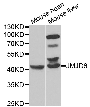 JMJD6 / PSR Antibody - Western blot analysis of extracts of various cell lines, using JMJD6 antibody.