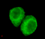 JMJD6 / PSR Antibody - Immunocytochemistry of HeLa cells using anti-JMJD6(N-terminus) mouse monoclonal antibody diluted 1:200.