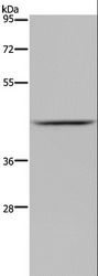 JMJD6 / PSR Antibody - Western blot analysis of Mouse liver tissue, using JMJD6 Polyclonal Antibody at dilution of 1:800.