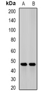 JMJD6 / PSR Antibody - Western blot analysis of JMJD6 expression in mouse heart (A); mouse liver (B) whole cell lysates.