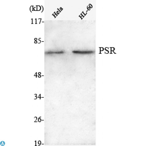 JMJD6 / PSR Antibody - Western Blot (WB) analysis using PSR Monoclonal Antibody against HeLa, HL-60 cell lysate.