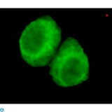JMJD6 / PSR Antibody - Immunofluorescence (IF) analysis of HeLa cells using PSR Monoclonal Antibody.