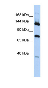 JMJD7 Antibody - PLA2G4B / CPLA2-Beta antibody Western blot of Fetal Brain lysate. This image was taken for the unconjugated form of this product. Other forms have not been tested.