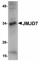 JMJD7 Antibody - Western blot of JMJD7 in 3T3 cell lysate with JMJD7 antibody at 1 ug/ml. Below: Immunohistochemistry of JMJD7 in rat liver tissue with JMJD7 antibody at 2.5 ug/ml.