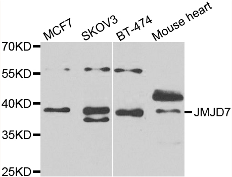 JMJD7 Antibody - Western blot analysis of extracts of various cell lines.