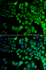 JMJD7 Antibody - Immunofluorescence analysis of A549 cells.