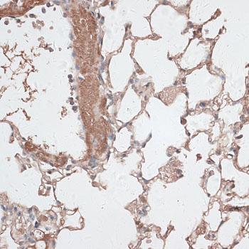 JMJD7 Antibody - Immunohistochemistry of paraffin-embedded Mouse lung using JMJD7 Polyclonal Antibody at dilution of 1:100 (40x lens).
