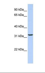 JMJD8 Antibody - MCF7 cell lysate. Antibody concentration: 1.0 ug/ml. Gel concentration: 12%.  This image was taken for the unconjugated form of this product. Other forms have not been tested.