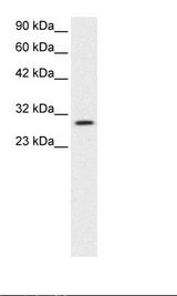 JMJD8 Antibody - Jurkat Cell Lysate.  This image was taken for the unconjugated form of this product. Other forms have not been tested.