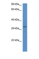 JMJD8 Antibody - JMJD8 antibody Western blot of Mouse Pancreas lysate. Antibody concentration 1 ug/ml.  This image was taken for the unconjugated form of this product. Other forms have not been tested.