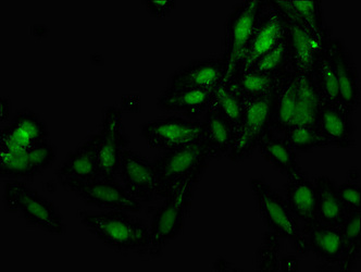 JMY Antibody - Immunofluorescence staining of Hela cells at a dilution of 1:133, counter-stained with DAPI. The cells were fixed in 4% formaldehyde, permeabilized using 0.2% Triton X-100 and blocked in 10% normal Goat Serum. The cells were then incubated with the antibody overnight at 4 °C.The secondary antibody was Alexa Fluor 488-congugated AffiniPure Goat Anti-Rabbit IgG (H+L) .