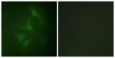 JNK1+2+3 Antibody - Immunofluorescence analysis of HeLa cells, using JNK1/2/3 Antibody. The picture on the right is blocked with the synthesized peptide.