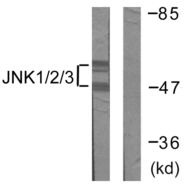 JNK1+2+3 Antibody - Western blot analysis of lysates from 293 cells, treated with UV 5', using JNK1/2/3 Antibody. The lane on the right is blocked with the synthesized peptide.