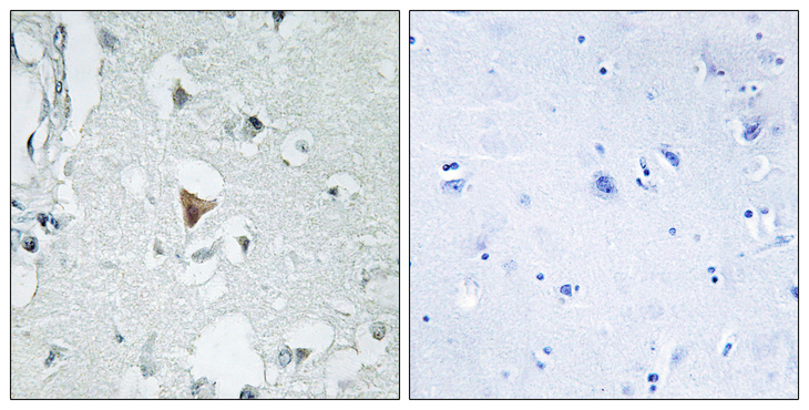 JNK1+2+3 Antibody - Immunohistochemistry analysis of paraffin-embedded human brain tissue, using SAPK/JNK Antibody. The picture on the right is blocked with the synthesized peptide.