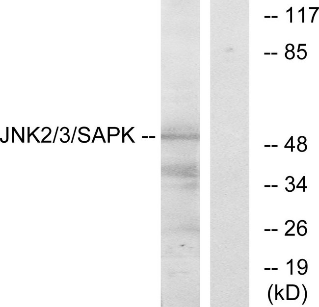 JNK1+2+3 Antibody - Western blot analysis of lysates from HepG2 cells, using SAPK/JNK Antibody. The lane on the right is blocked with the synthesized peptide.