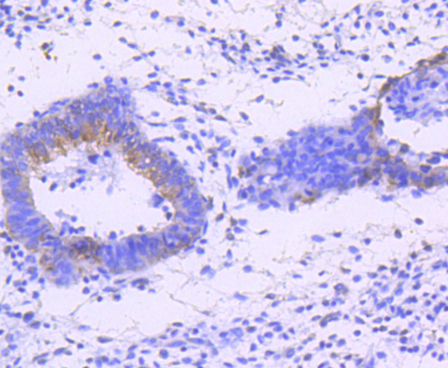 JNK1+2+3 Antibody - Immunohistochemistry of paraffin-embedded human uterus.