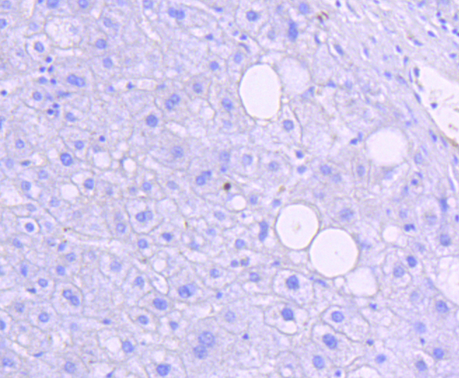 JNK1+2+3 Antibody - Immunohistochemistry of paraffin-embedded human liver tissue.