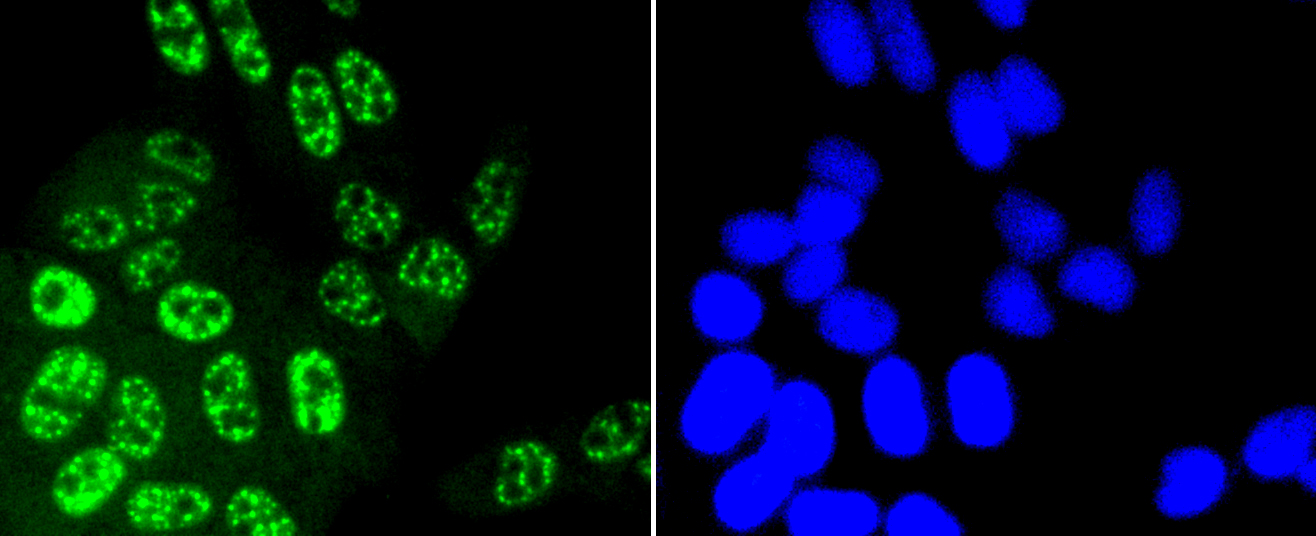 JNK1+2+3 Antibody - Immunofluorescence analysis of Hela cells.
