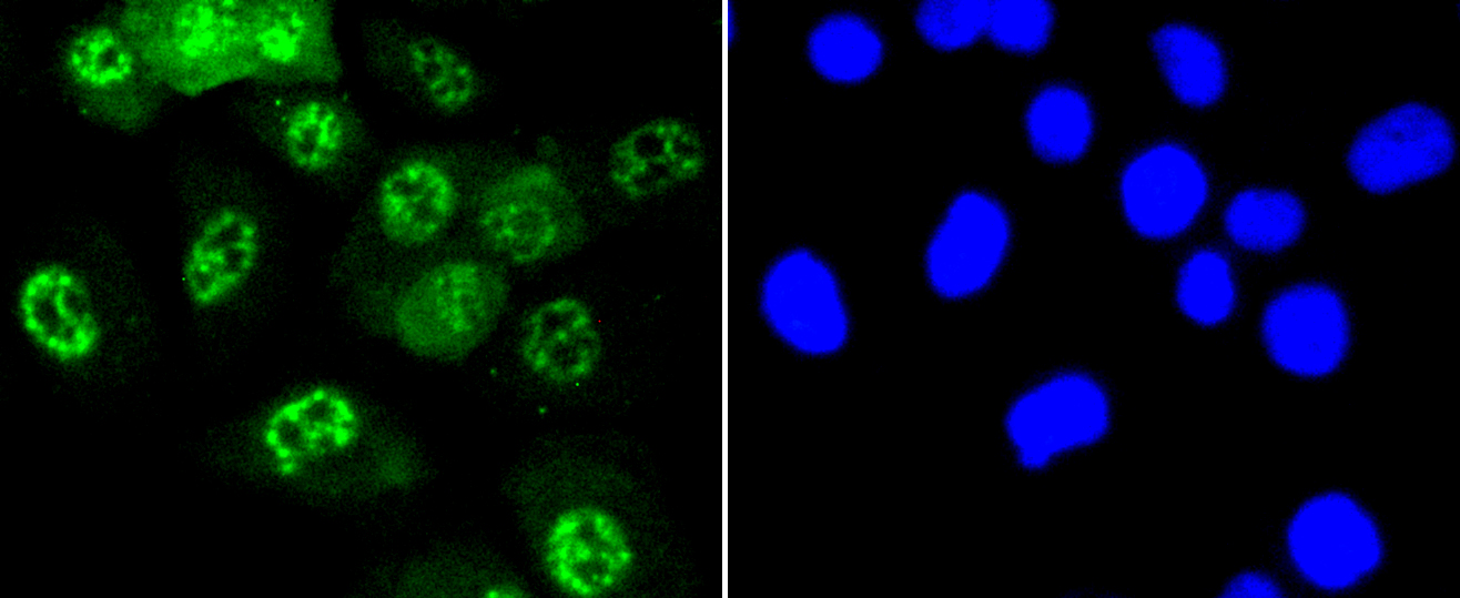 JNK1+2+3 Antibody - Immunofluorescence analysis of HUVEC cells.