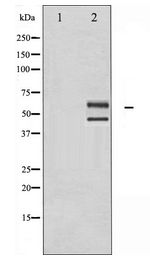 JNK1+2+3 Antibody - Western blot of JNK1/2/3 expression in UV treated 293 whole cell lysates,The lane on the left is treated with the antigen-specific peptide.