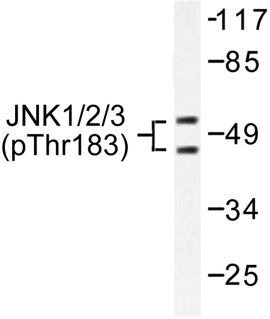 JNK1+2+3 Antibody - Western blot of p-JNK1/2/3 (T183+Y185) pAb in extracts from 293 cells treated with UV, 5mins.