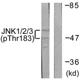 JNK1+2+3 Antibody - Western blot analysis of lysates from 293 cells treated with UV 5', using JNK1/2/3 (Phospho-Thr183+Tyr185) Antibody. The lane on the right is blocked with the phospho peptide.