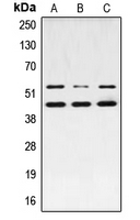 JNK1+2+3 Antibody - Western blot analysis of JNK1/2/3 (pT183) expression in MCF7 PMA-treated (A); NIH3T3 UV-treated (B); PC12 PMA-treated (C) whole cell lysates.