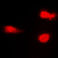 JNK1+2+3 Antibody - Immunofluorescent analysis of JNK1/2/3 (pT183) staining in NIH3T3 cells. Formalin-fixed cells were permeabilized with 0.1% Triton X-100 in TBS for 5-10 minutes and blocked with 3% BSA-PBS for 30 minutes at room temperature. Cells were probed with the primary antibody in 3% BSA-PBS and incubated overnight at 4 C in a humidified chamber. Cells were washed with PBST and incubated with a DyLight 594-conjugated secondary antibody (red) in PBS at room temperature in the dark. DAPI was used to stain the cell nuclei (blue).