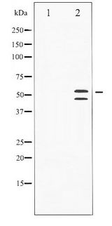 JNK1+2+3 Antibody - Western blot of SAPK/JNK phosphorylation expression in Anisomycin treated HeLa whole cell lysates,The lane on the left is treated with the antigen-specific peptide.