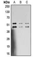 JNK1+2+3 Antibody - Western blot analysis of JNK1/2/3 (pT183/Y185) expression in MCF7 UV-treated (A); SP20 UV-treated (B); PC12 UV-treated (C) whole cell lysates.