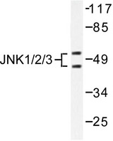 JNK1+2+3 Antibody - Western blot of JNK1/2/3 (T178) pAb in extracts from 293 cells treated with UV, 5mins.